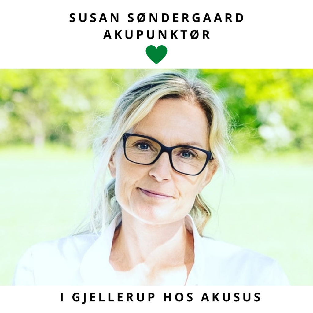 Akupunktur hos Susan Søndergaard